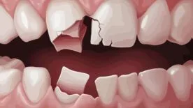 Đánh gãy răng có đi tù không?